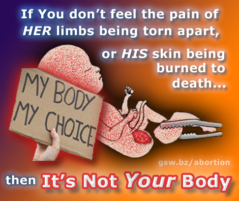 It's Not Your Body, v2.png