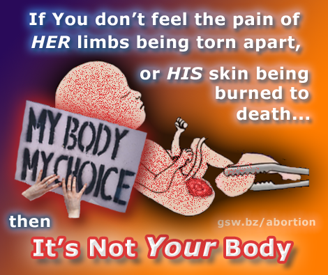 It's Not Your Body, v3.png